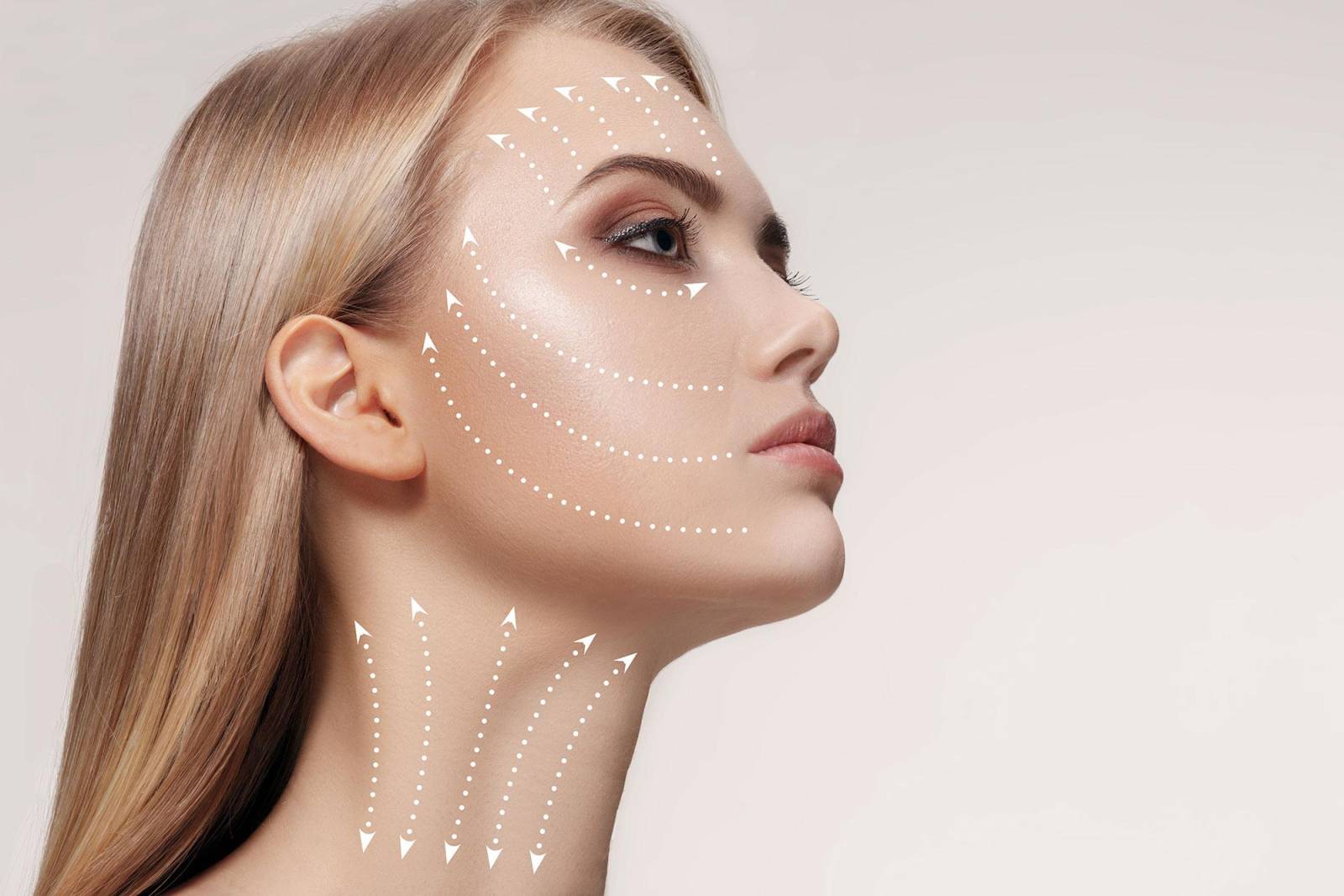 Pose de fils tenseurs au Centre Jouvence à Carry-le-Rouet : une solution experte pour rajeunir sans chirurgie