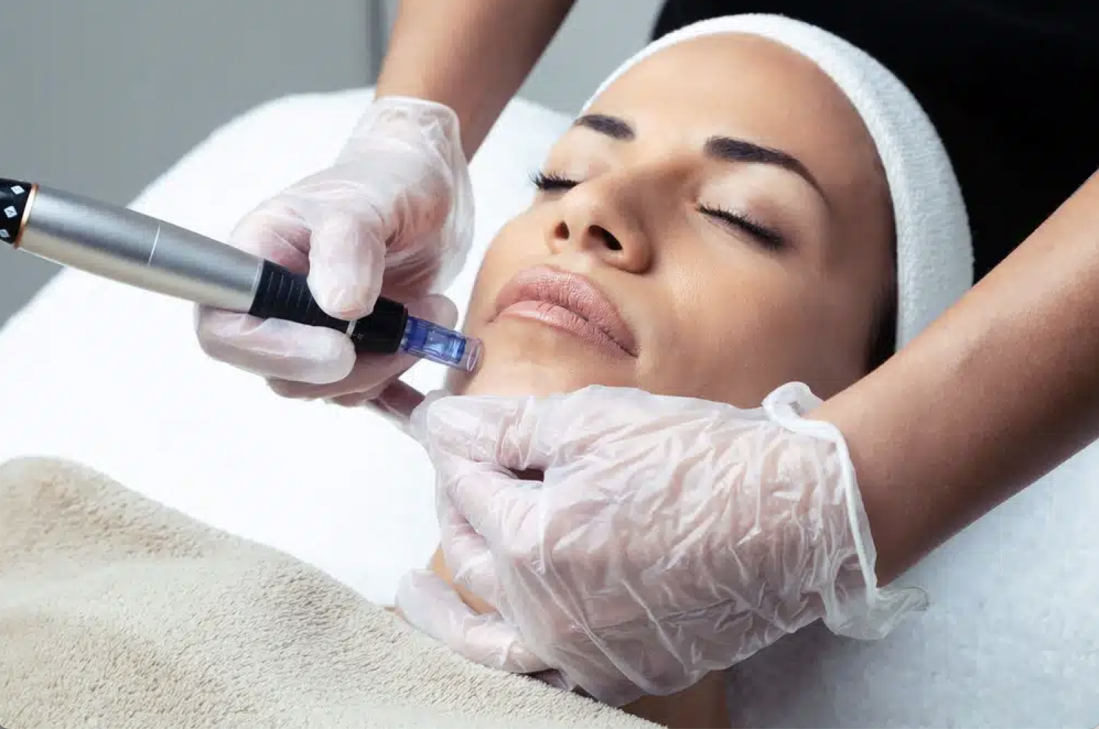 Mésothérapie par Microneedling Dermapen avec Filorga NCTF 135 HA au Centre Jouvence à Carry-le-Rouet