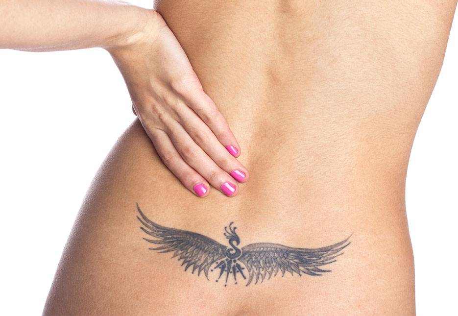 Détatouage Marseille Pas cher