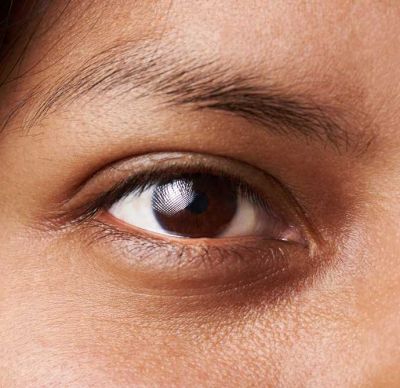 Notre zone d'activité pour ce service Détatouage chimique par institut de soins esthétiques