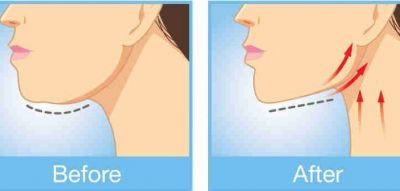 Nos prestations sur le secteur de Marseille